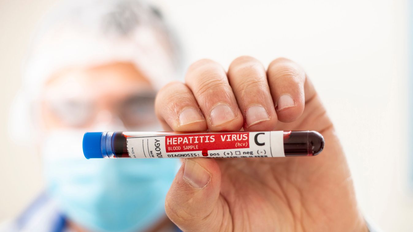 Idén 200 millió forinttal több jut a vírusos hepatitis szűrésére