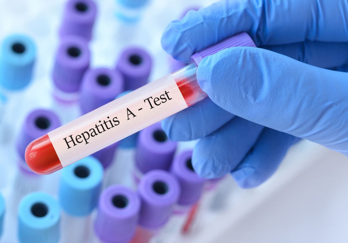 The,Doctor,Holds,A,Test,Blood,Sample,Tube,With,HepatitisA